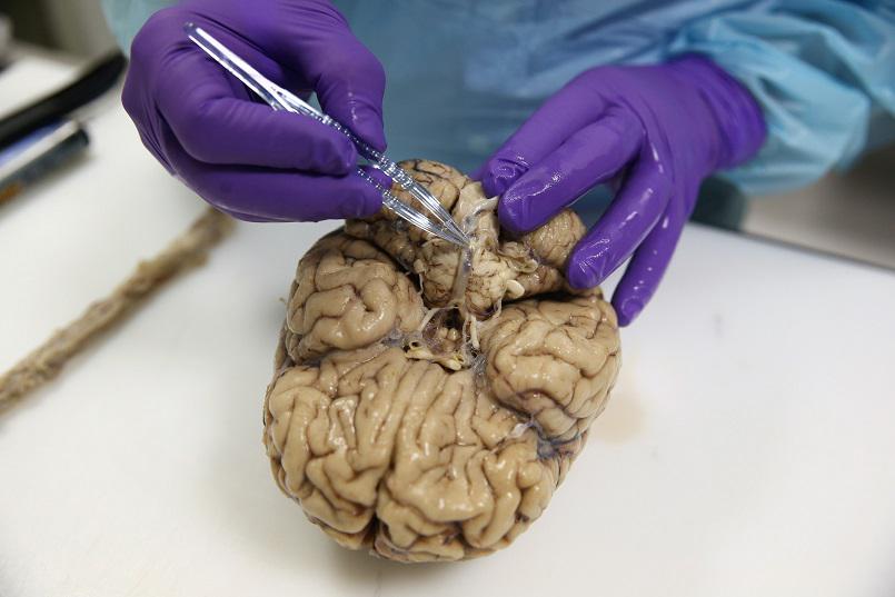 دماغ بشري