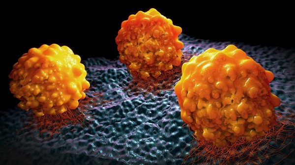 الخلايا السرطانية للثدي