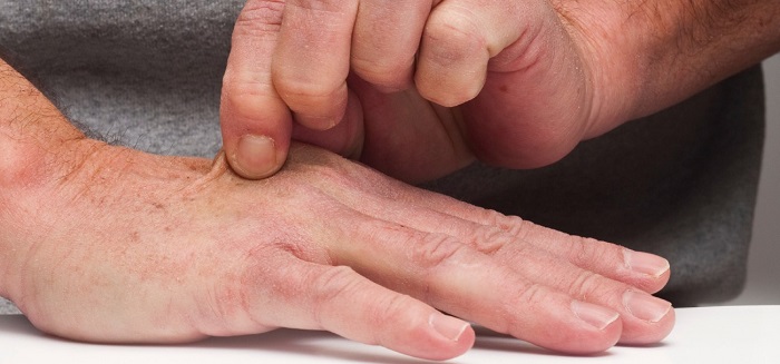 للجفاف مخاطر كبيرة على الإدراك والتفكير