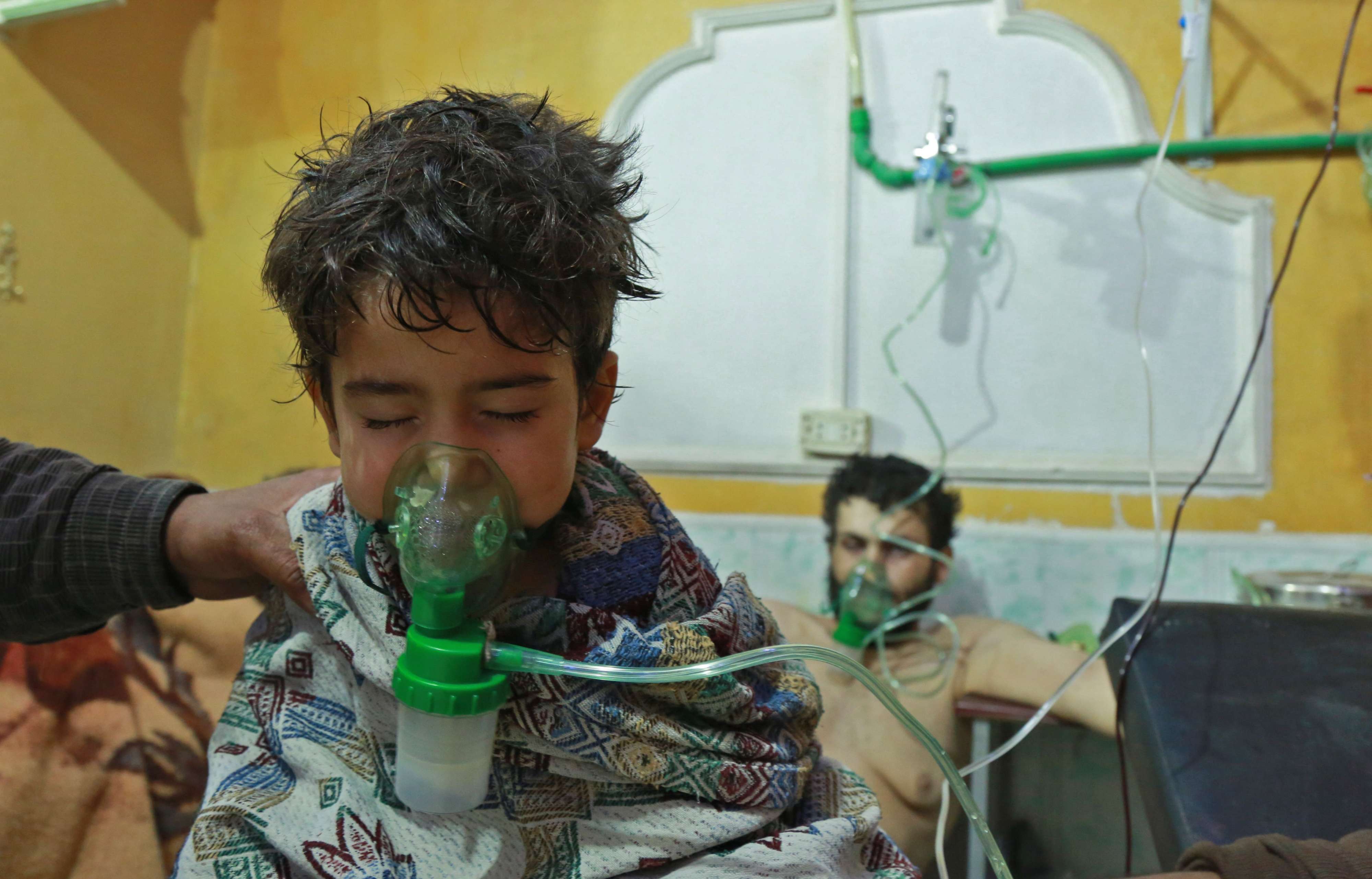  الأطفال بعد الكيماوي بسوريا