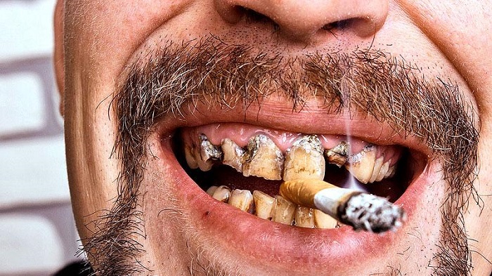تفشي الإدمان يضع نهاية للسجائر الإلكترونية المنكّهة