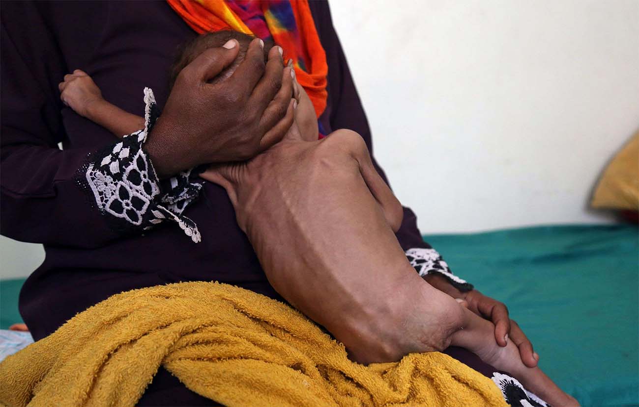 Alarming situation in Yemen