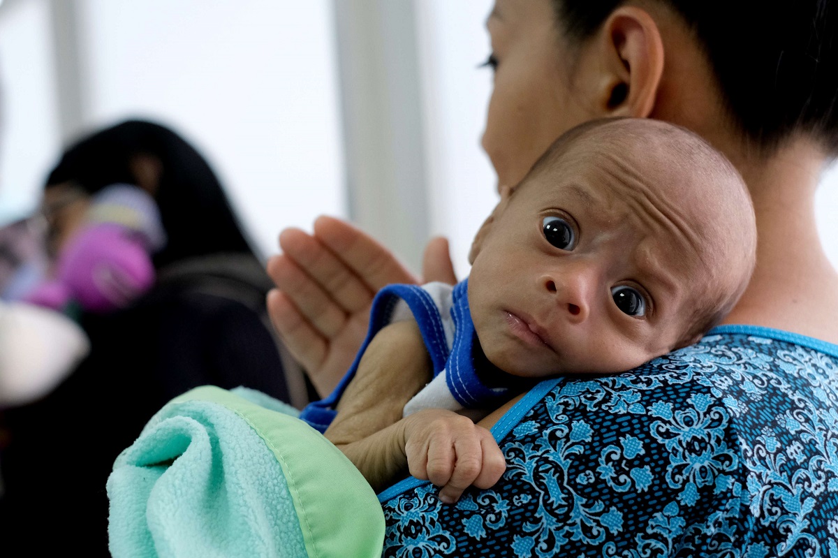 أم من مدغشقر تحمل طفلها الذي يعاني من سوء في التغذية