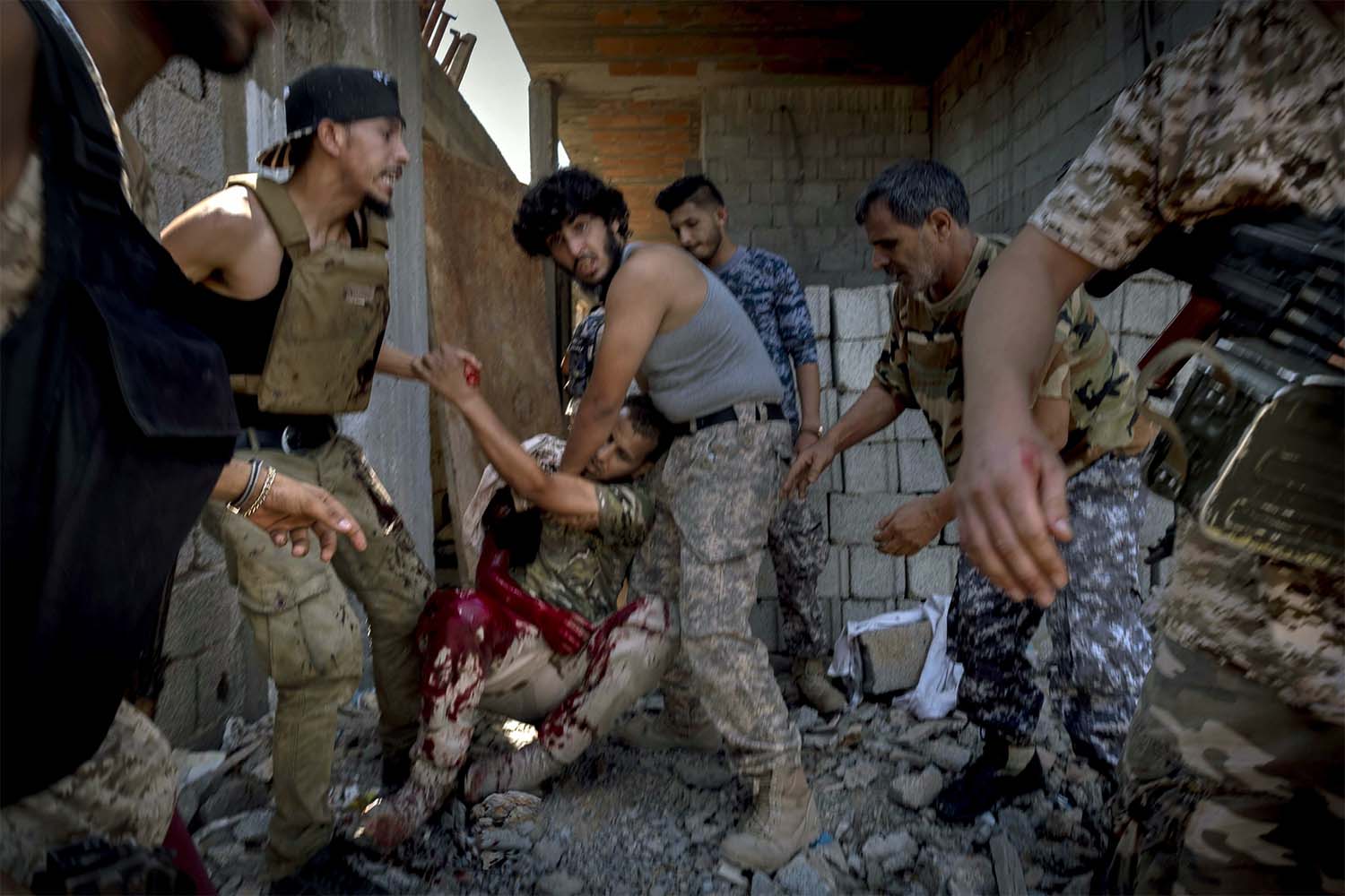 Injured GNA fighter