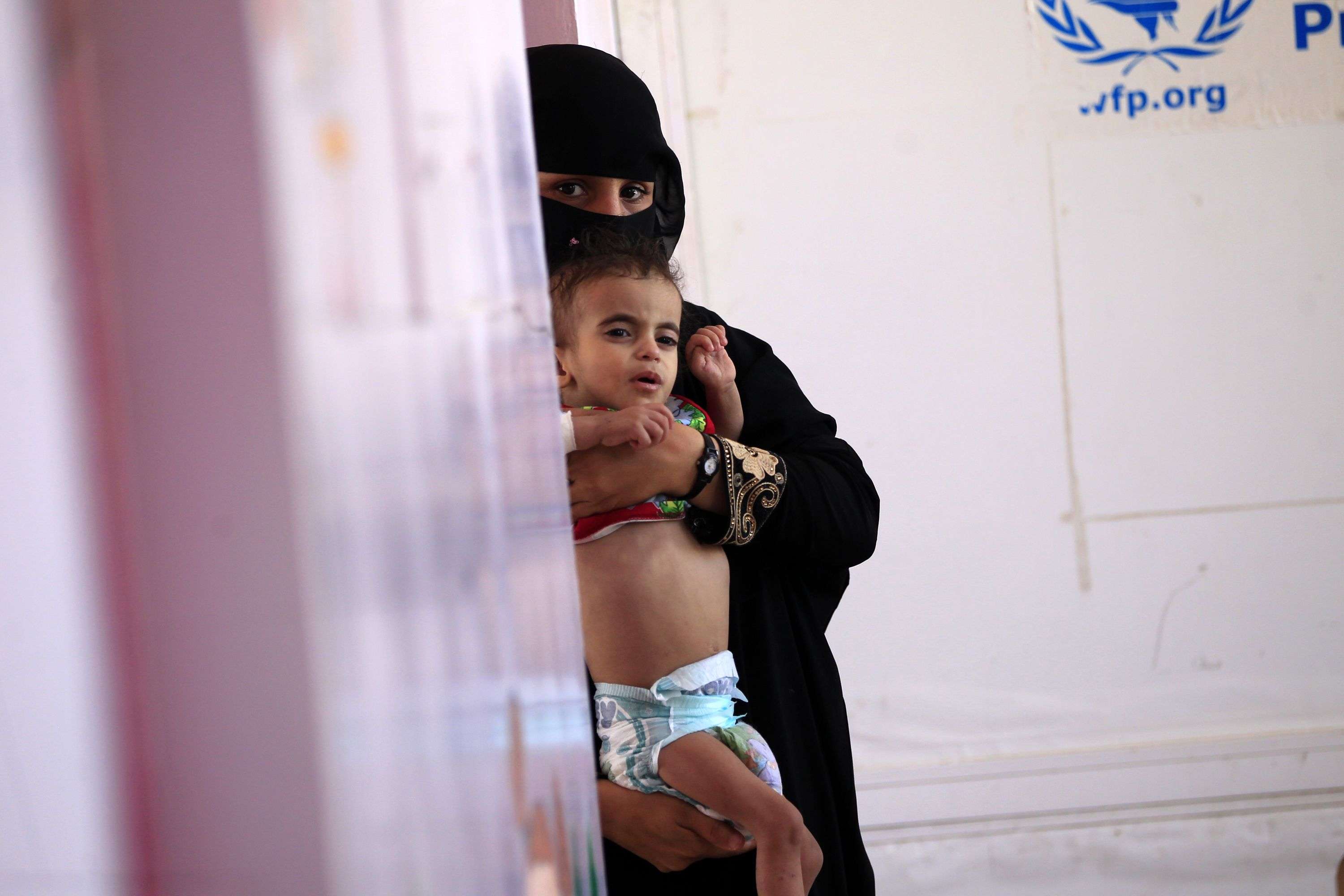 الحوثيون تورطوا في تعميق الازمة الانسانية بسرقة المساعدات الاممية واتلاف الاطنان منها