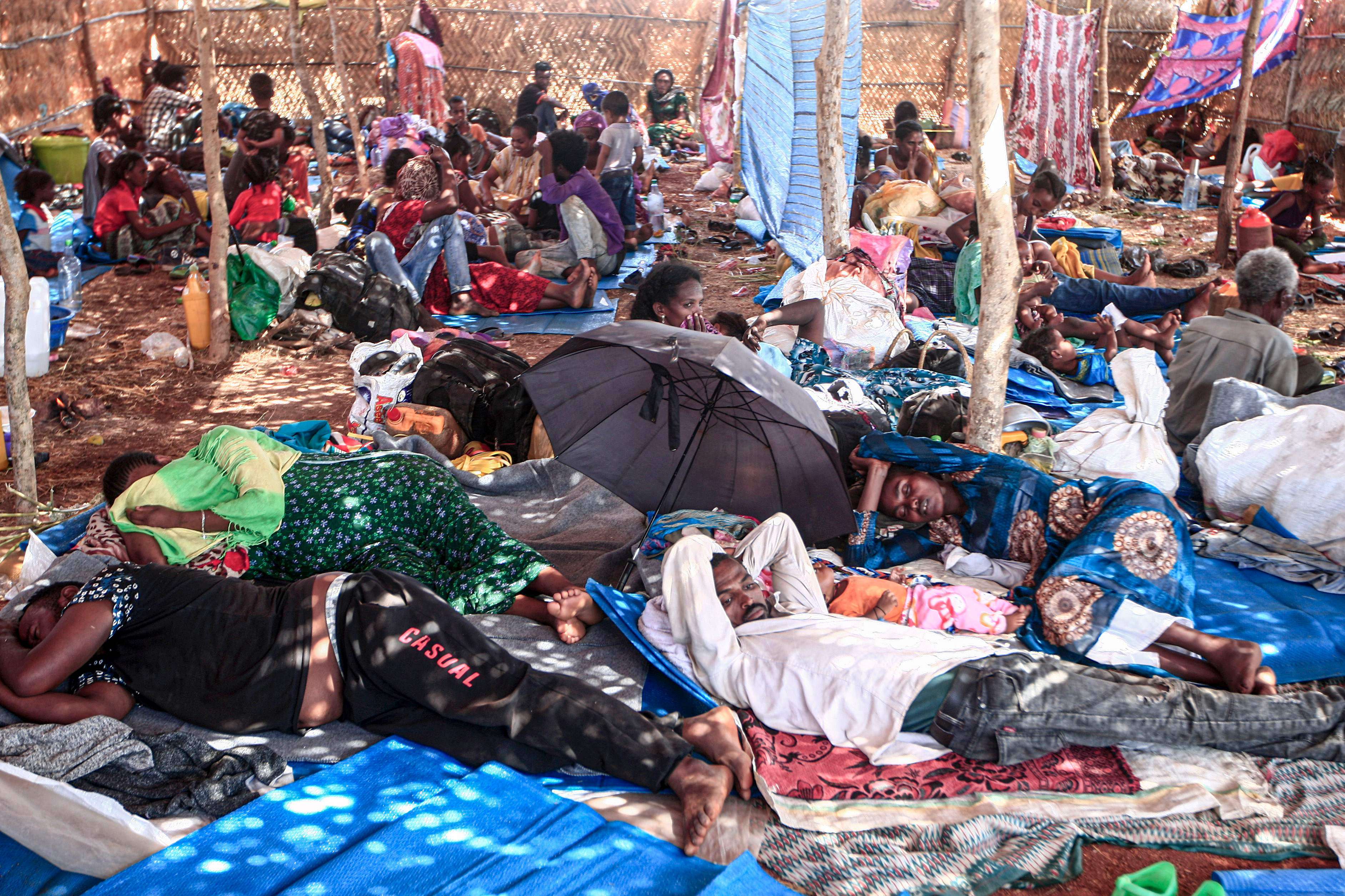 كارثة إنسانية تلوح في الأفق بسبب الجرب في اثيوبيا