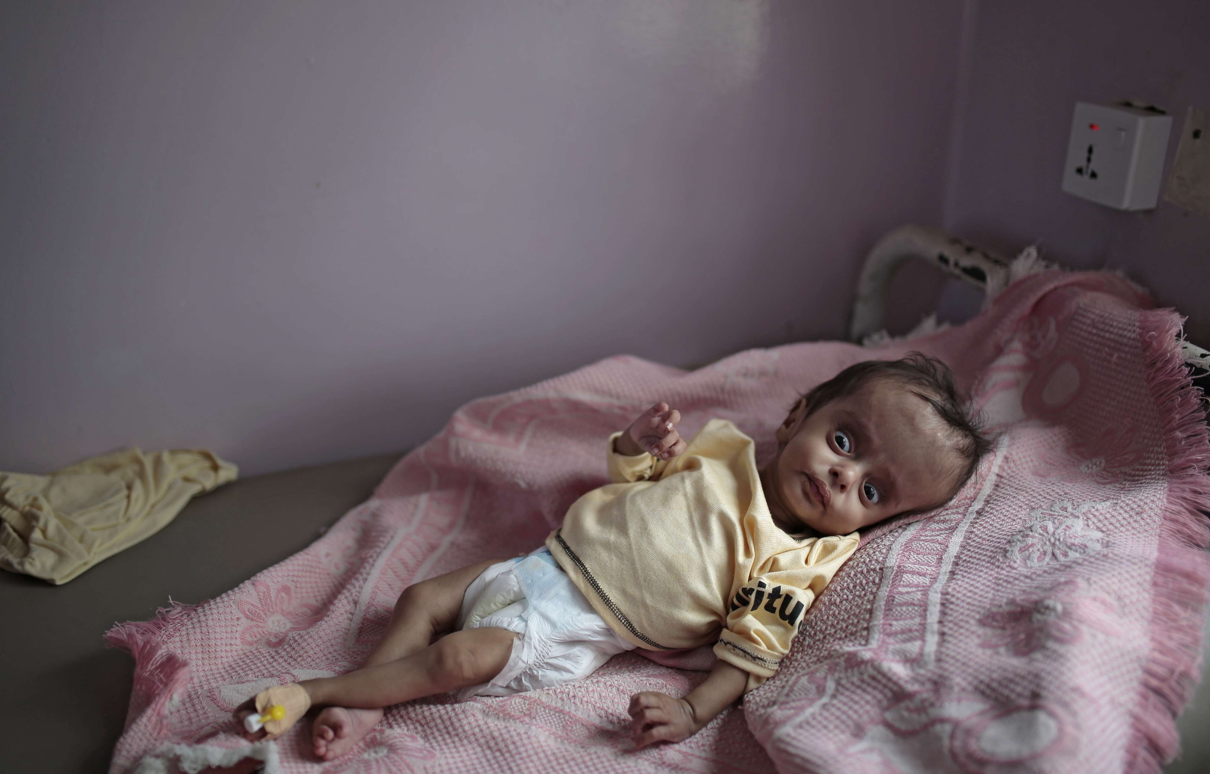 مخاوف أممية بشأن أوضاع أكثر سوء باليمن في ظل تمرد الحوثيين