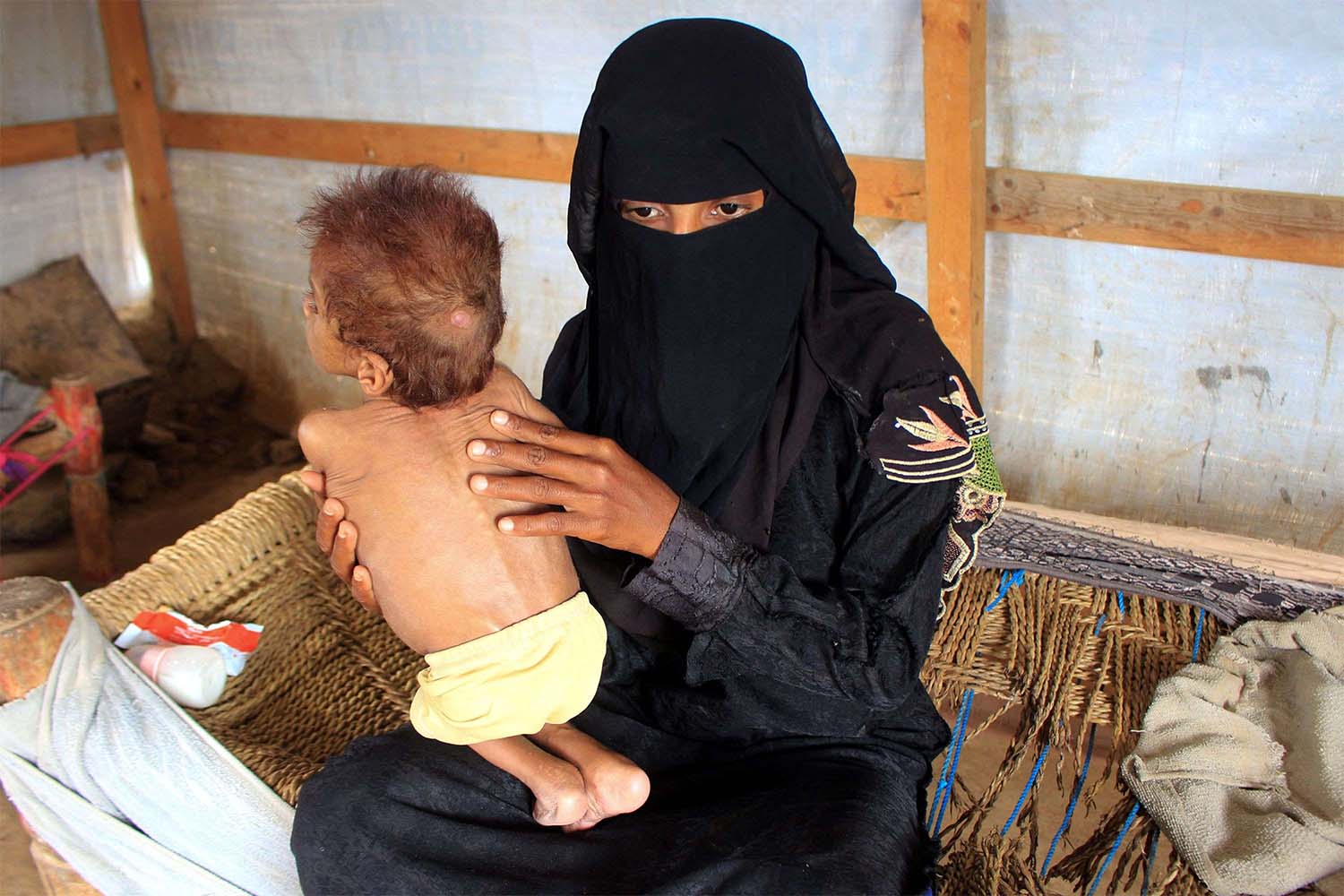 Yemen on the brink of large-scale famine