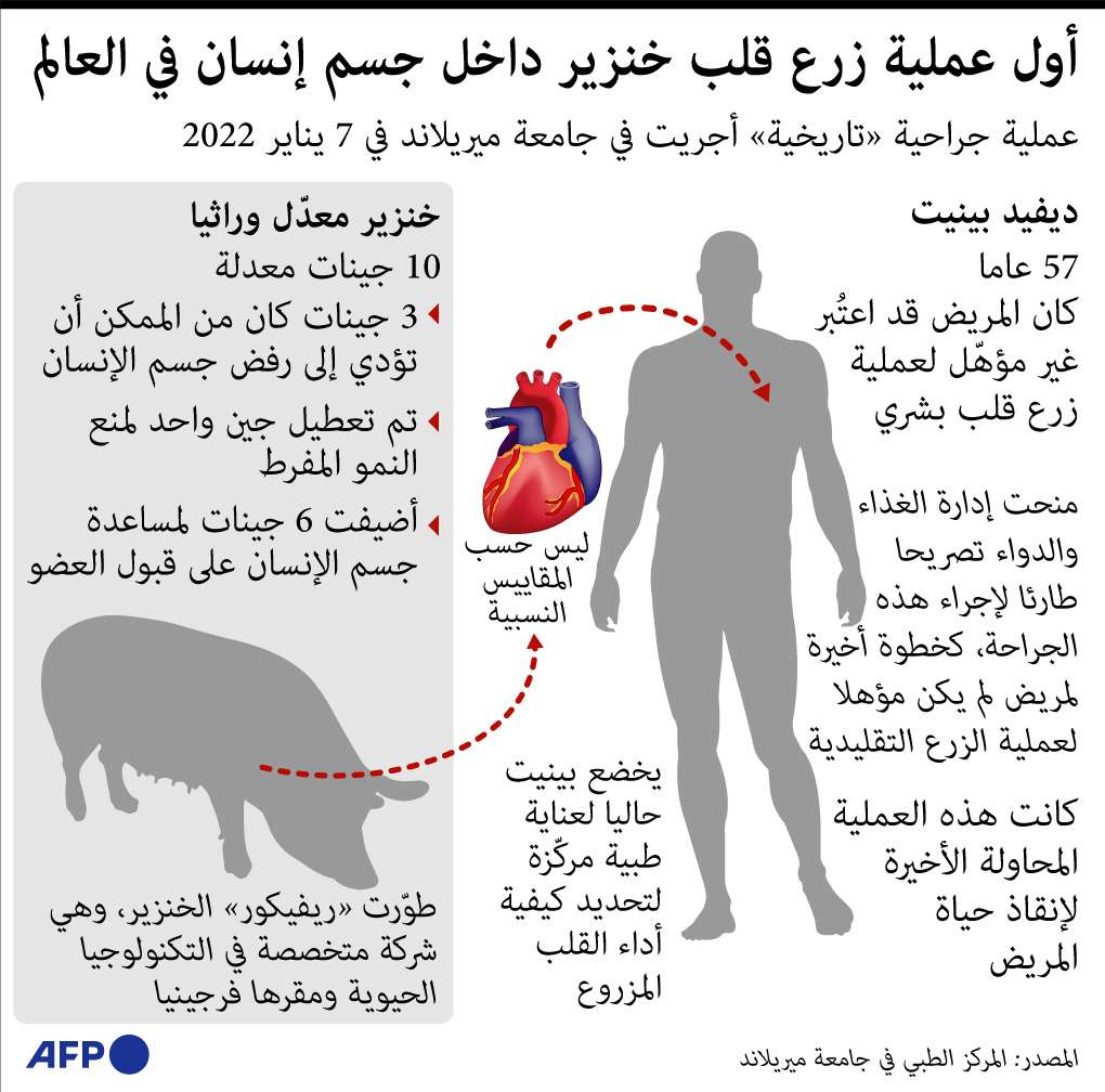 عملية زراعة قلب خنزير في جسم بشري