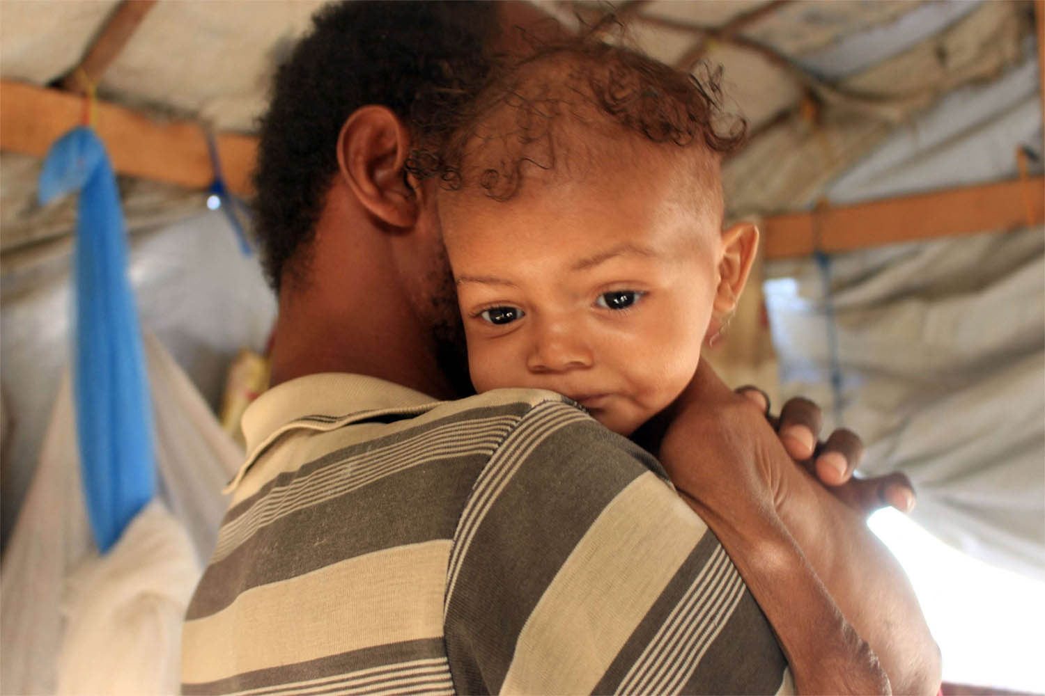 Nearly $4.3 billion is sought to help more than 17 million people across Yemen this year