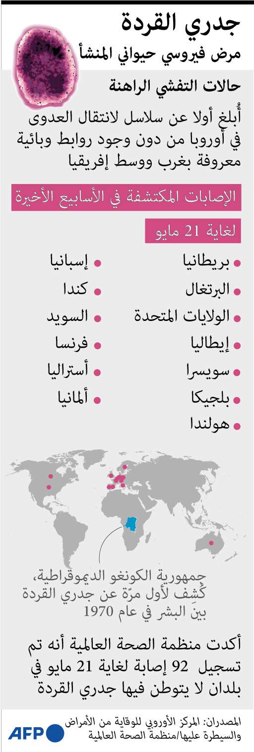 جدري القرود