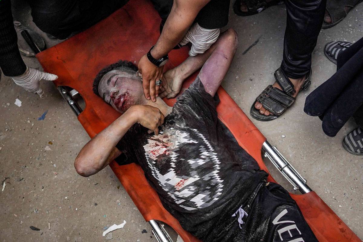 جريح فلسطيني تم انتشاله من تحت انقاض مبنى مدمر في غزة