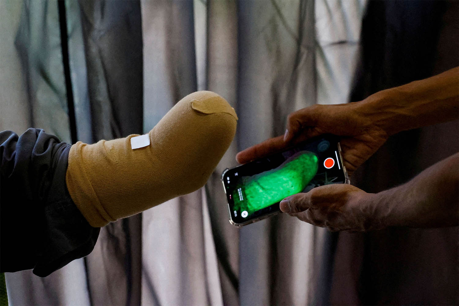 Bioniks hopes to pioneer a large-scale solution for people impacted by the war