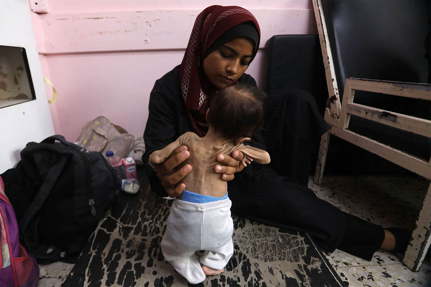 A Palestinian mother holds her malnourished 2-months-old daughter as they await treatment at the Nasser hospital in Khan Yunis