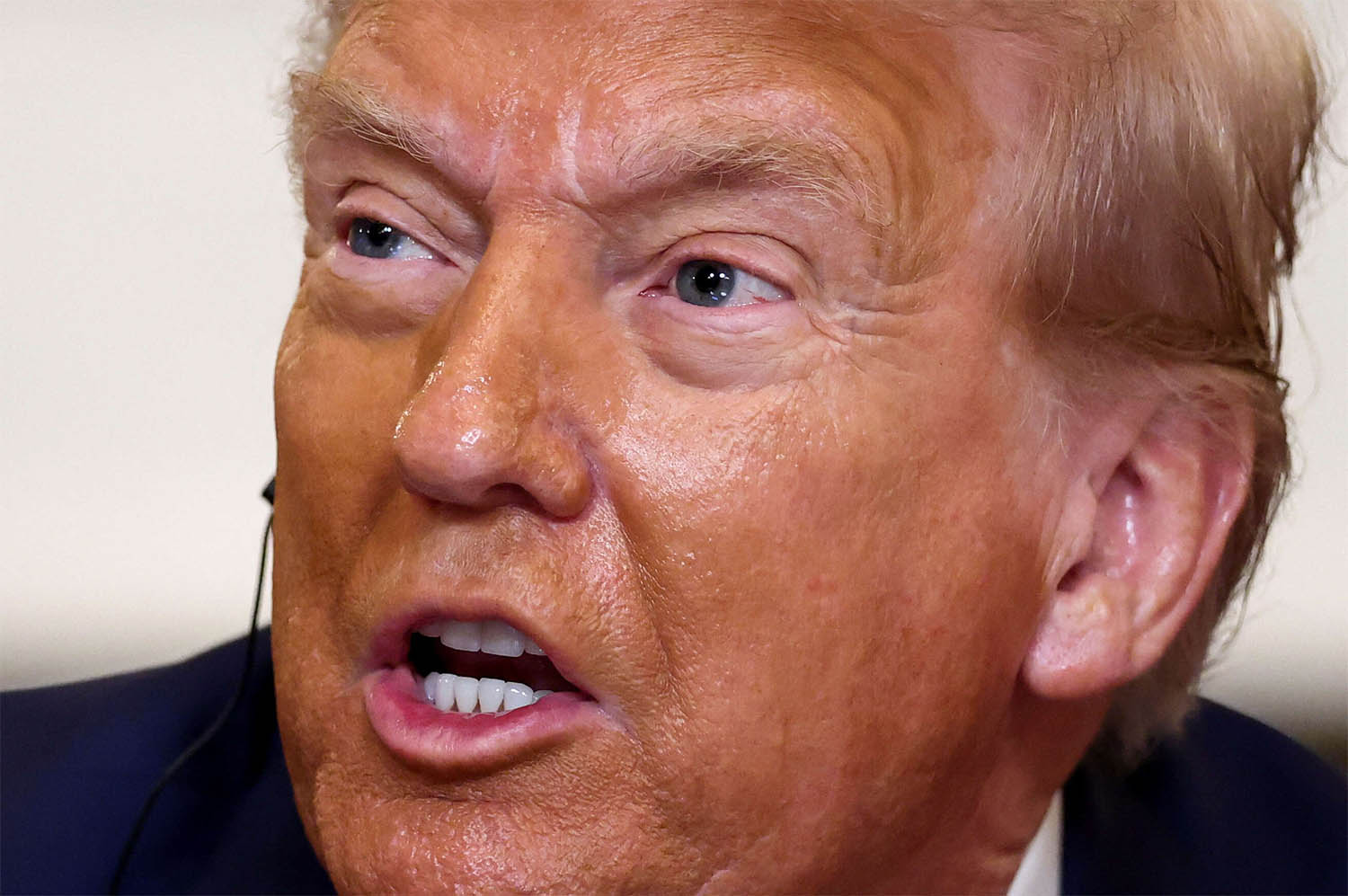 Will Trump broker a ceasefire soon?