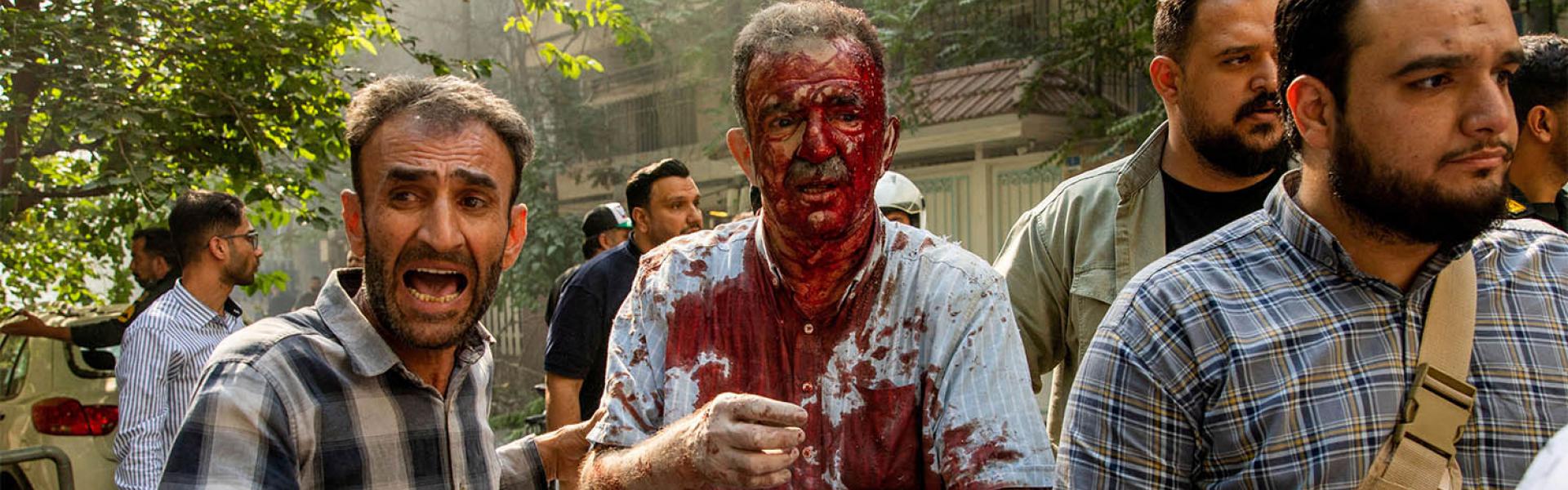 A wounded man reacts following the Israeli strikes on Tehran