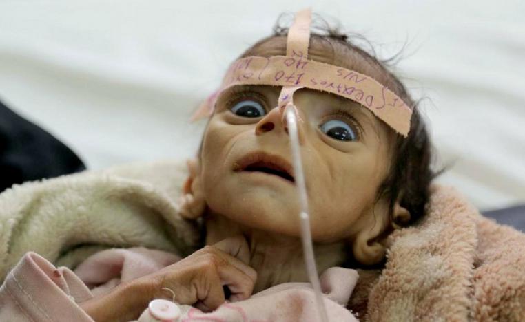 التغير المناخي يهدد البشر بسوء التغذية 