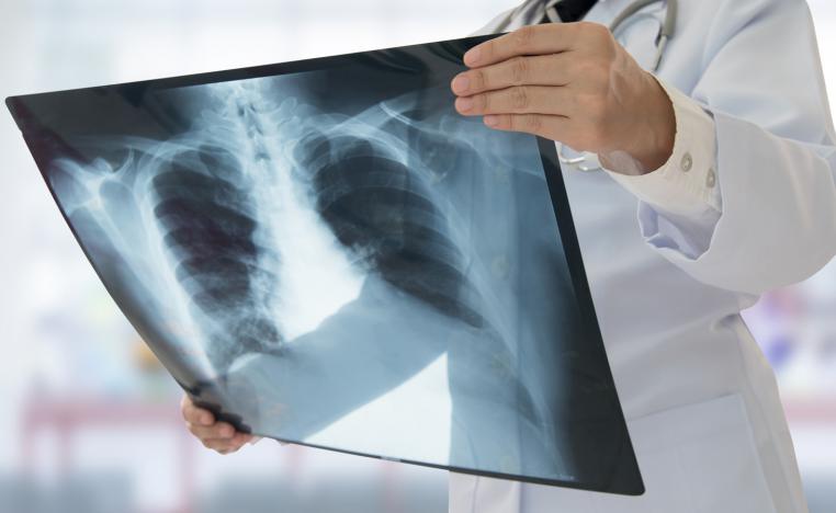 طبيب يفحص صورة بالأشعة لرئة مريض