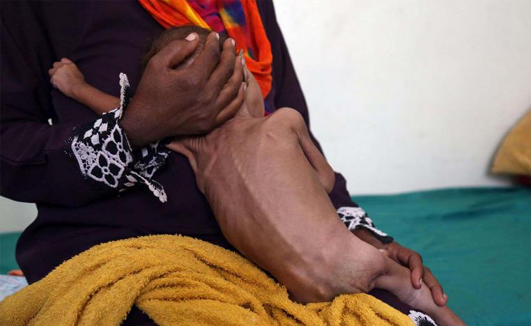 Alarming situation in Yemen