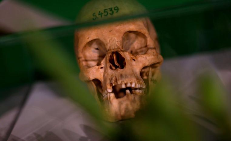 جمجمة لرجل ألماني توفي بداية القرن العشرين