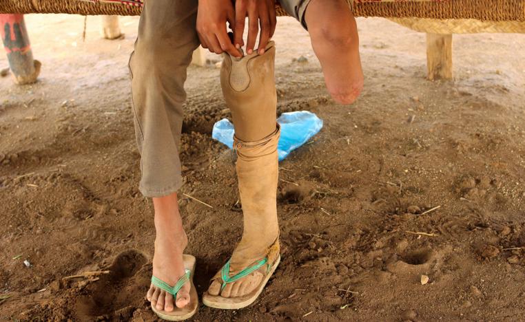 Ismail Abdullah, 12, who lost his leg in an air strike two years ago, sits in his hut at a camp for internally displaced people in Khamis of Hodeidah province