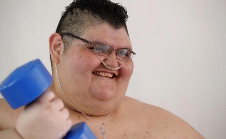 شاب مكسيكي يعاني من سمنة مفرطة