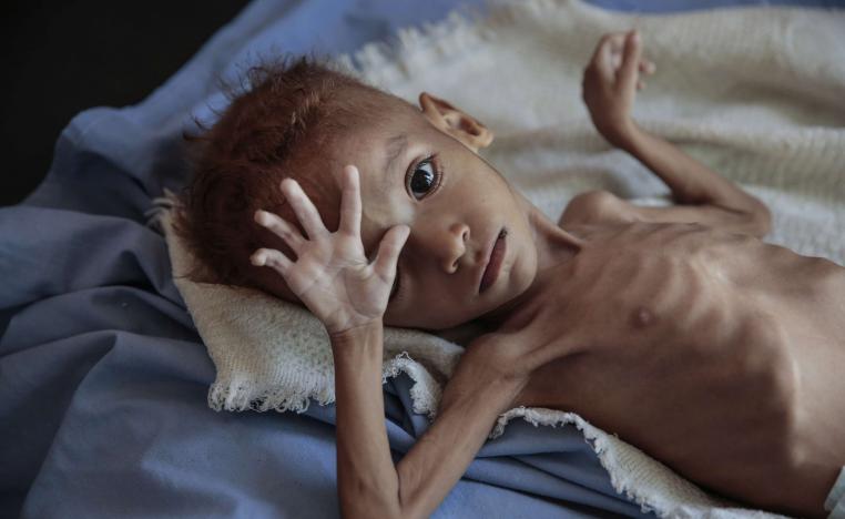 انتشار المجاعة في اليمن