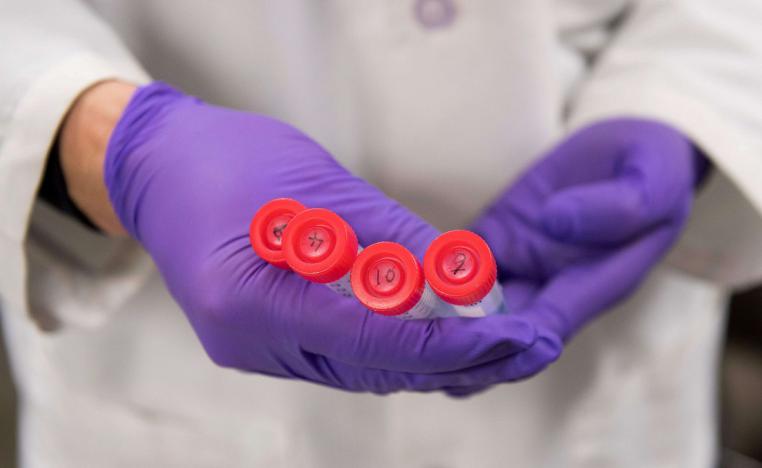 طبيب اميركي يحمل انابيب اختبار للكشف عن السرطان