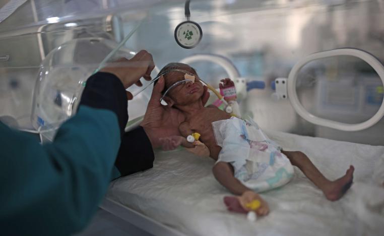 الموت يحيط بأطفال اليمن بسبب سوء التغذية والمرض