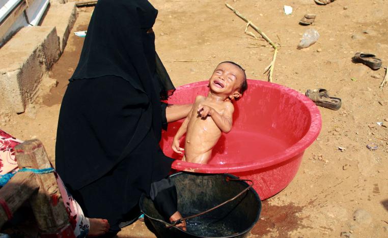 صورة تعكس مدى معاناة اليمنيين بالمناطق الخاضعة لسيطرة الحوثيين