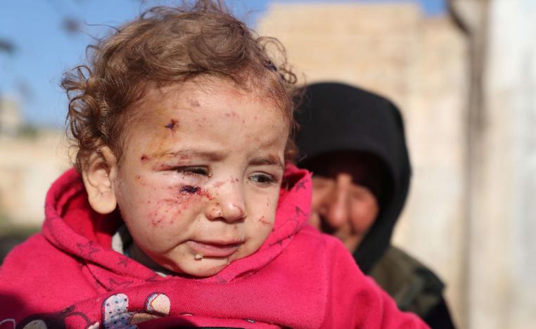 طفلة سورية جريحة