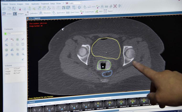 فحوصات للسرطان