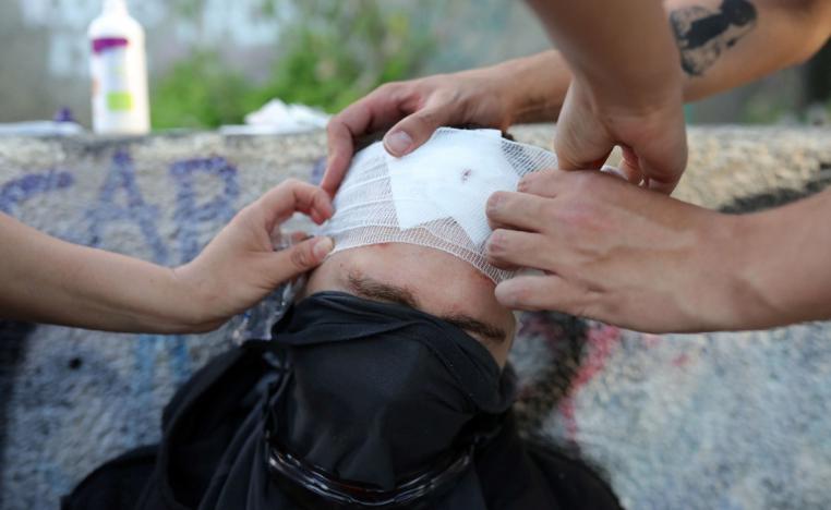 متظاهر تشيلي مصاب بجروح خلال احتجاج ضد حكومة بلده