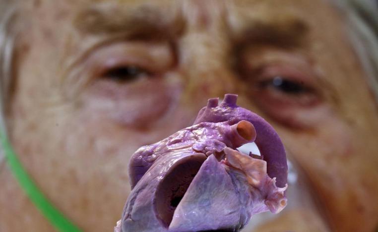 قلب بلاستيكي يظهر أمام ملصق لمريض قلب في أحد المؤتمرات الطبية بهولندا