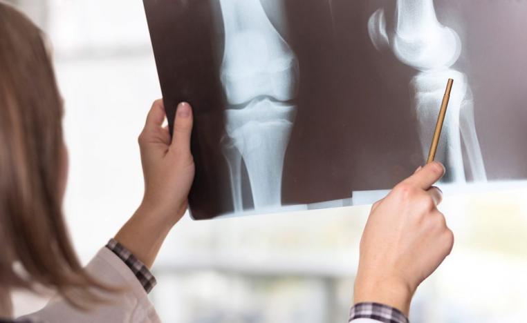 صورة لمفصل ركبة من موقع 'افريدي هيلث'