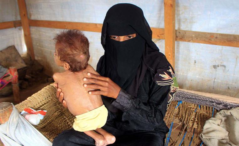 Yemen on the brink of large-scale famine