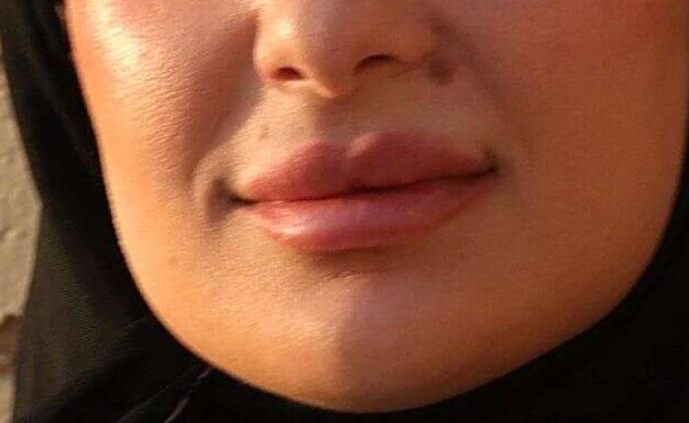 الأنف والفم 