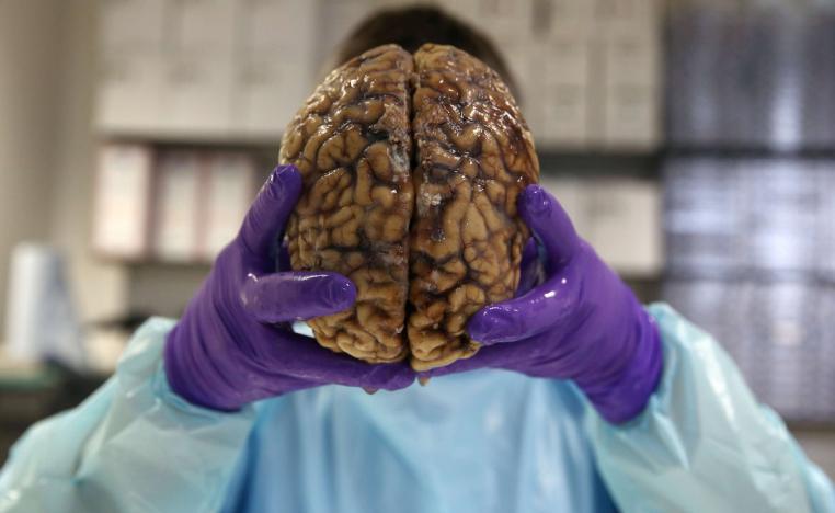 تركز على الدماغ