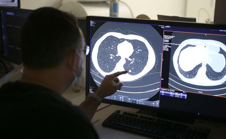 سرطان الرئة 