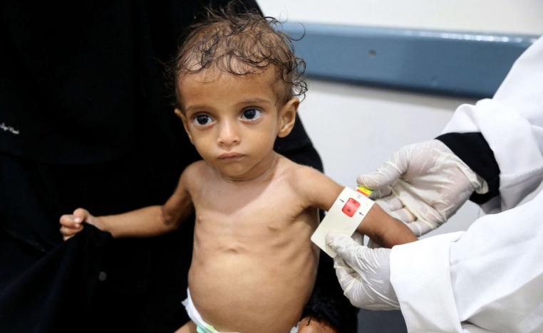 لا يمكن الوصول إلى ملايين الأطفال من خلال أنشطة التحصين الروتينية في اليمن