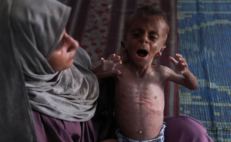 Hidaya, a 31-year-old Palestinian mother, cradles her sick 18-months old son Mohammed al-Mutawaq, who is also displaying signs of malnutrition