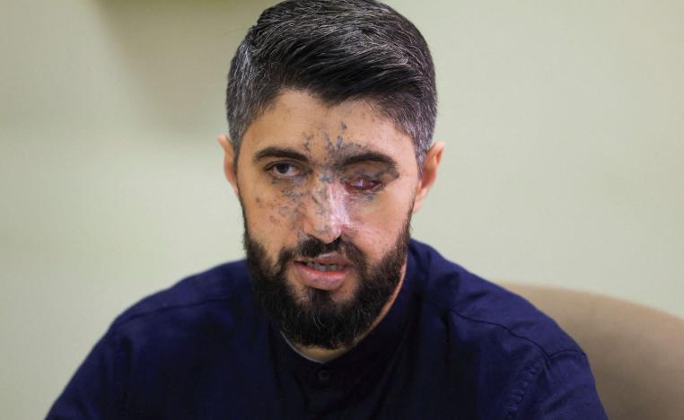 جراح لن تندمل