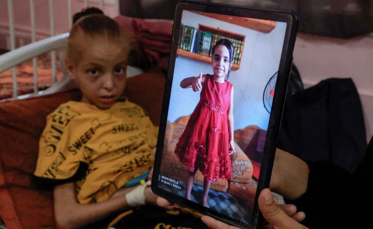 A Palestinian girl lies on a bed receiving treatment at the malnutrition ward at Nasser hospital, in Khan Younis, southern Gaza Strip, August 5, 2025. 