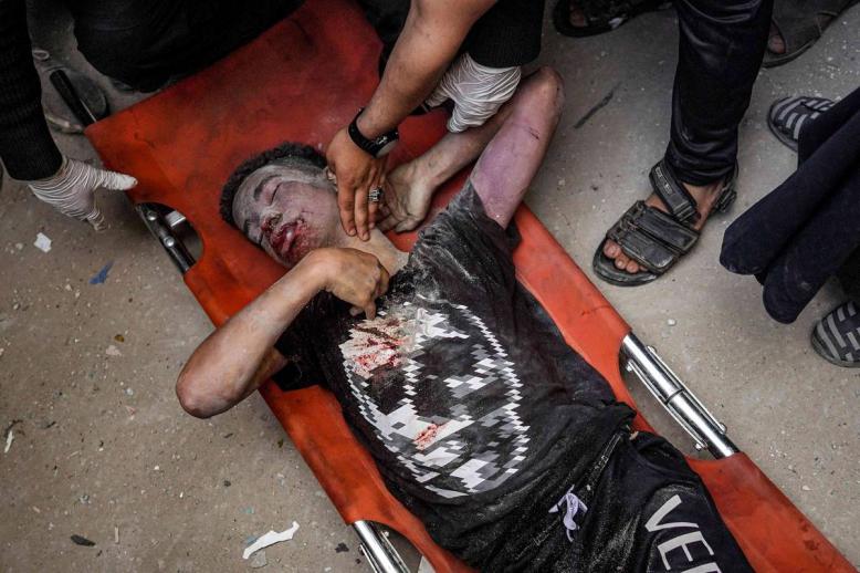 جريح فلسطيني تم انتشاله من تحت انقاض مبنى مدمر في غزة