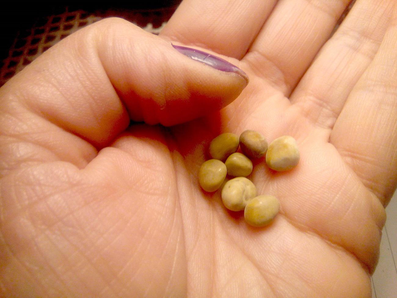 حصوات الكلى