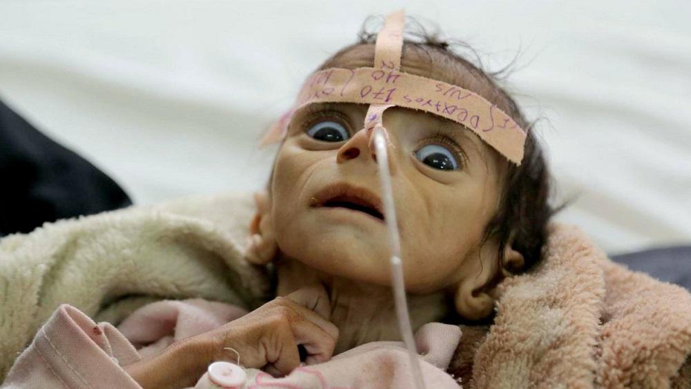 التغير المناخي يهدد البشر بسوء التغذية 