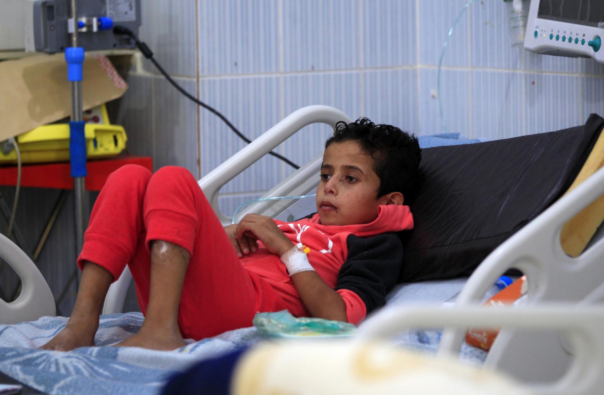 A Yemeni child suffering from a diphtheria infection receives treatment at a hospital in the capital Sanaa, on October 31, 2018.