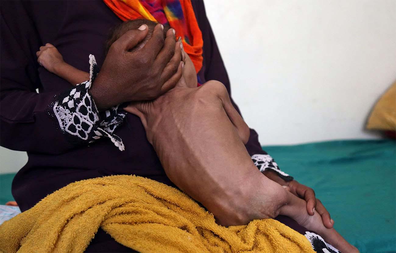 Alarming situation in Yemen