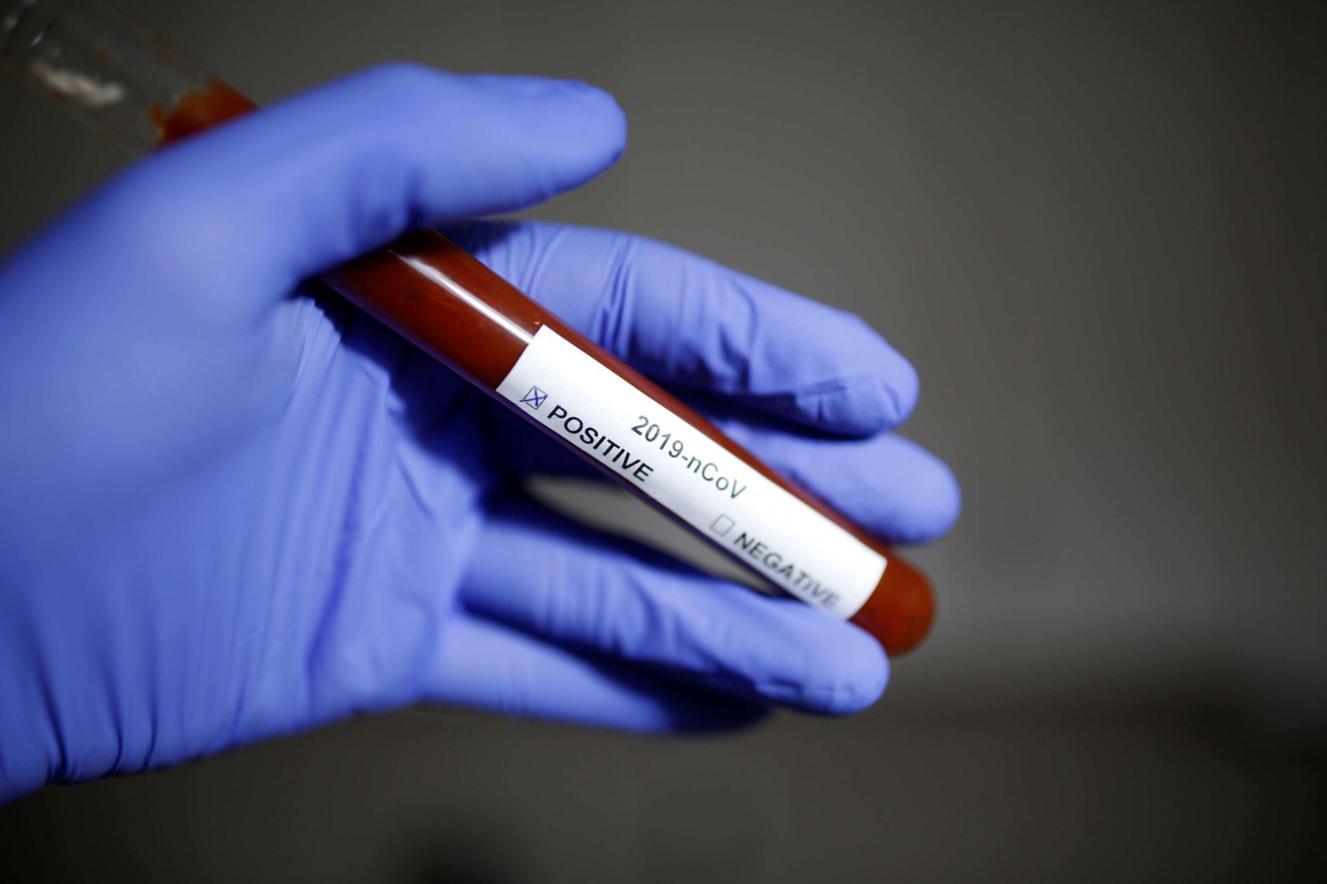 فيروس كورونا