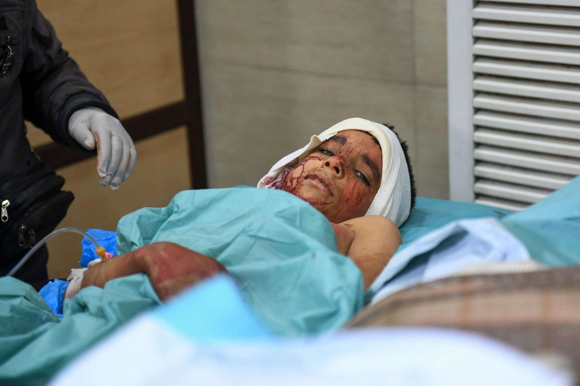 صبي مصاب في اليمن الحكومي